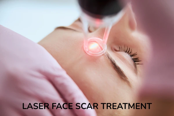 Laser Face Scar Treatment