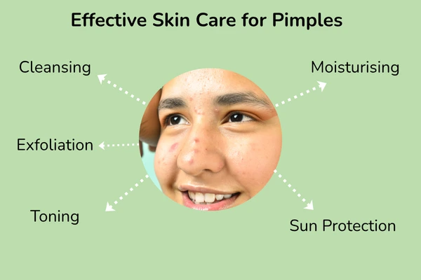 Effective skincare on how to get rid of teenage pimples