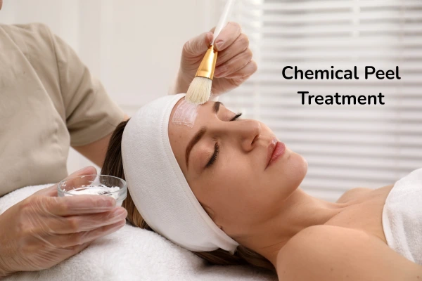 A dermatologist performing chemical peel treatment