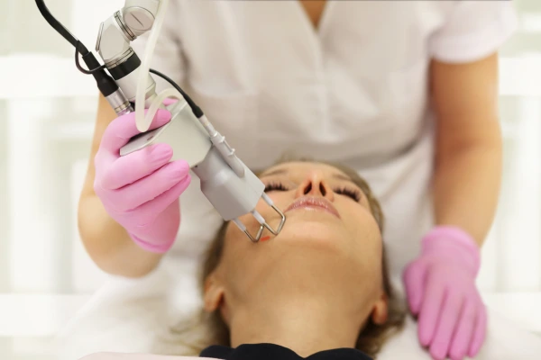 Fractional CO2 boxcar scars treatment