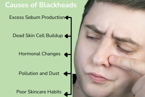 What causes blackheads on nose?
