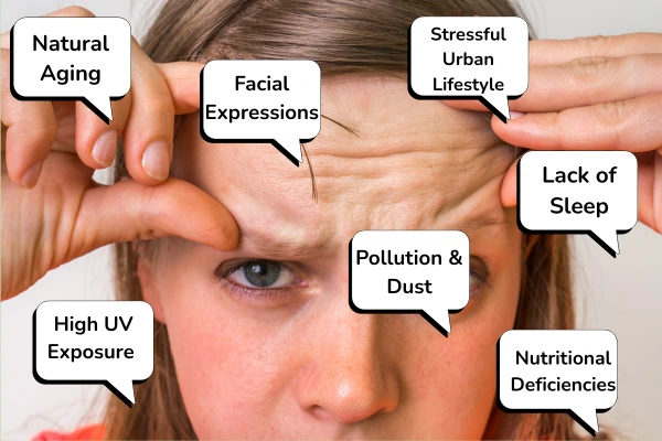 Wrinkles on forehead causes