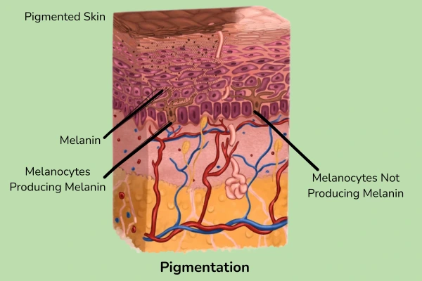 A scientific image explaining about the pigmentation