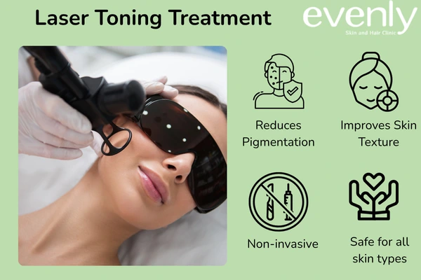 Laser toning treatment for pigmentation