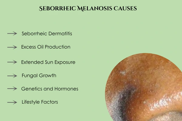 seborrheic melanosis causes