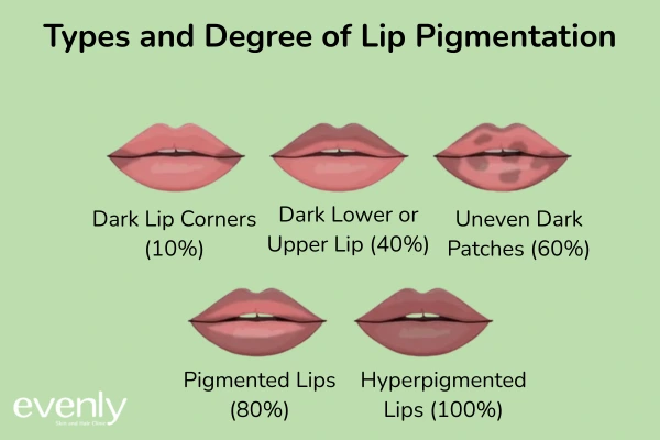 Types of Lip pigmentation & degree of pigmentation