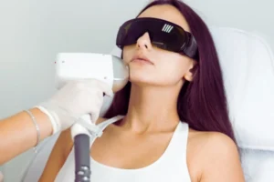 facial hair removal laser treatment