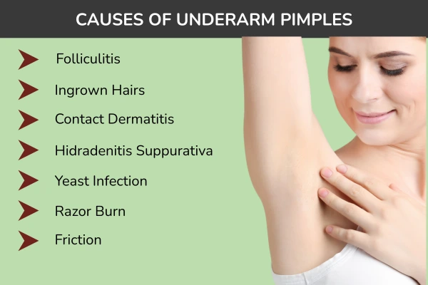 Causes of underarm pimples