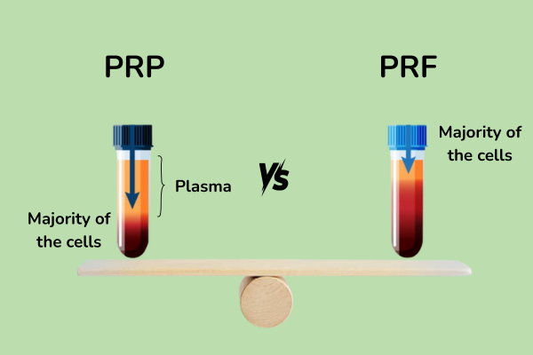 PRP vs PRF