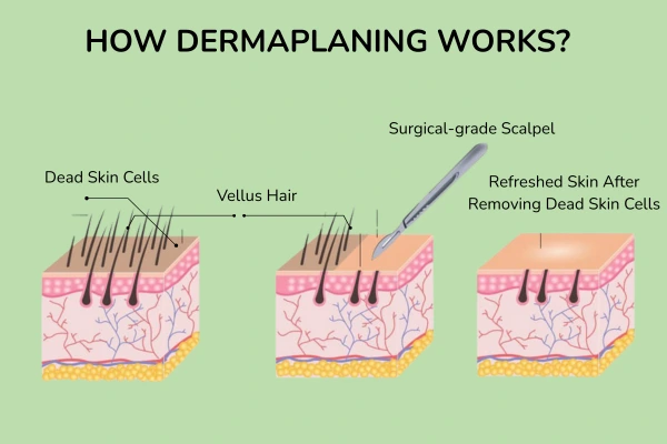 Scentific representation of dermaplaning treatment