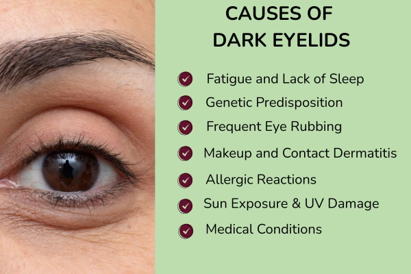 Causes of dark eyelids

