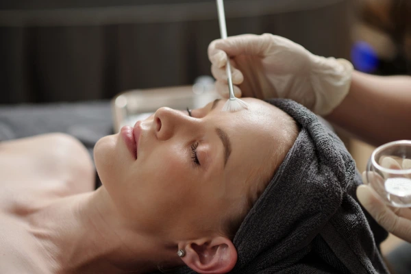 Chemical peel treatment