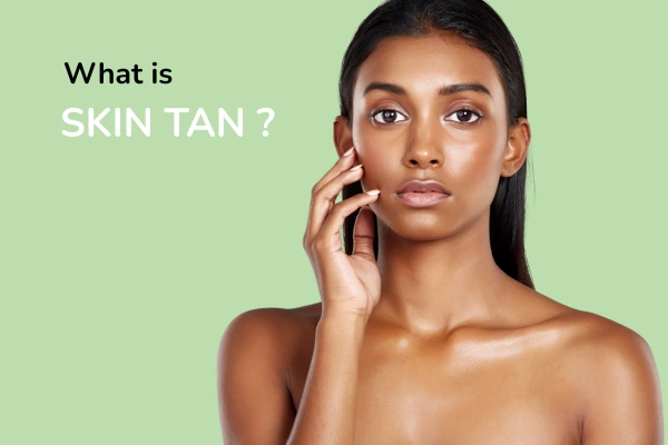 What is skin tan?