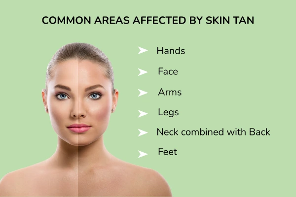 Common areas affected by skin tan