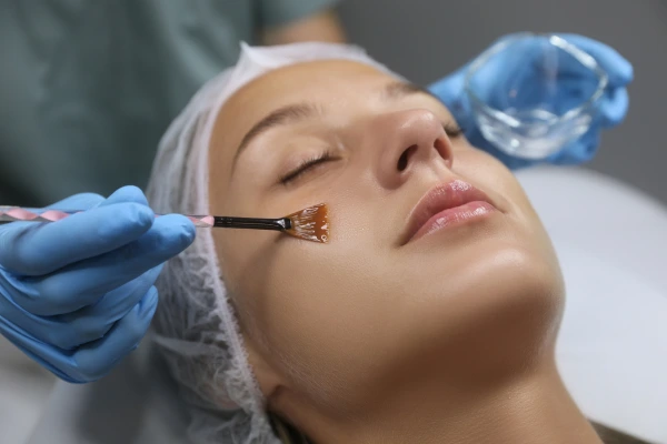 A dermatologist performing chemical peel treatment