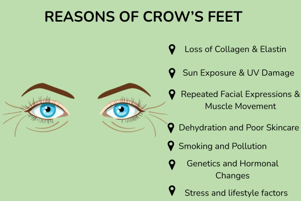 Causes of crows feet 