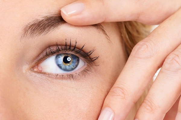 A women worried about her Crow's feet eyes