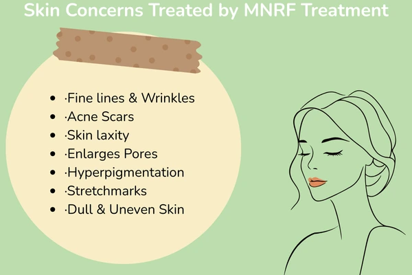 Skin concerns treated by MNRF Treatment