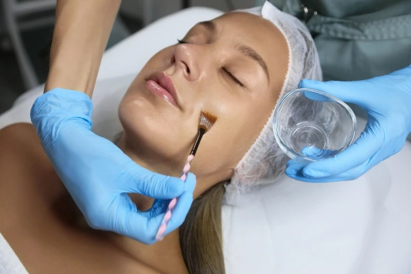A young women taking chemical peel treatment