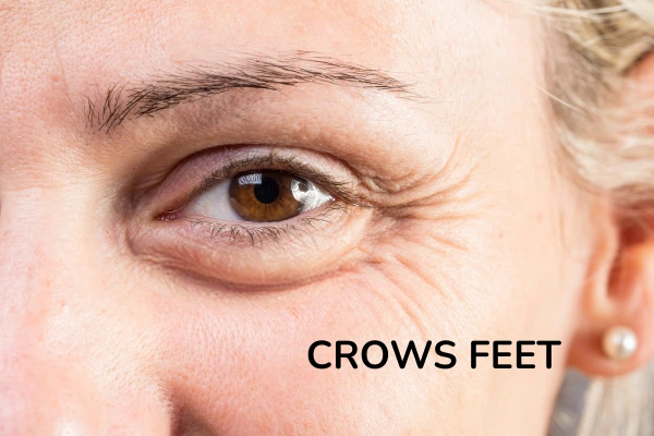 A women with crows feet
