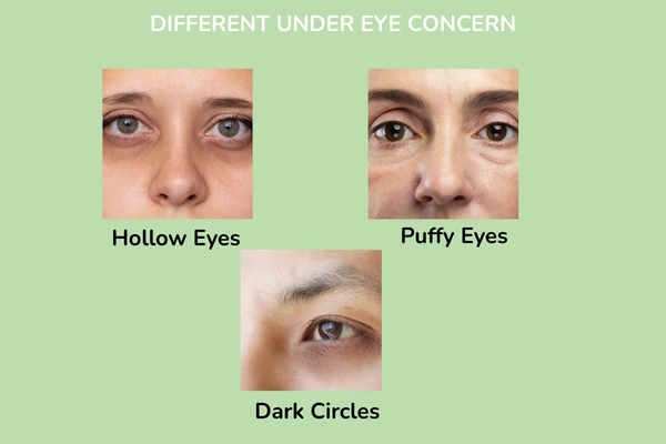 A different yunder eye concern