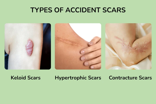 Types of accident scars