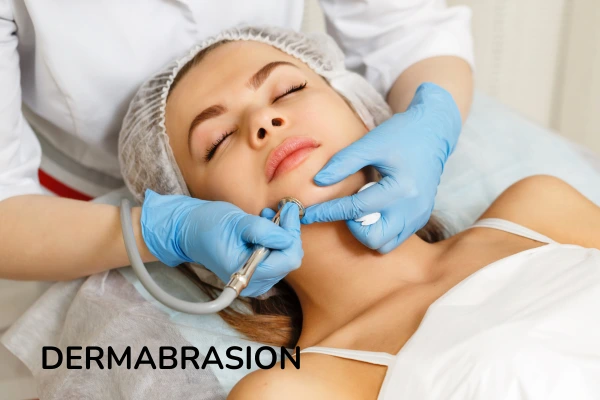 A women taking dermabrasion treatment