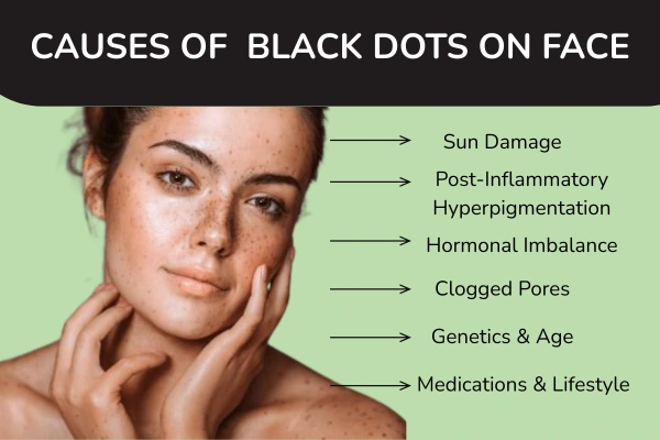 Causes of black dots on face