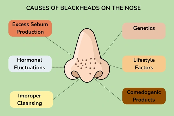 Causes of blackheads on nose