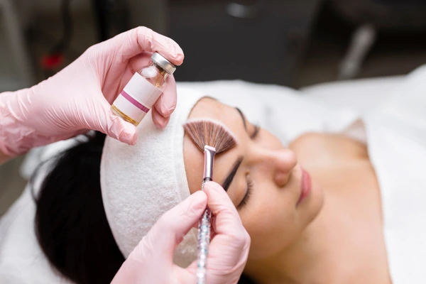 A dermatologist performing chemical peel treatment