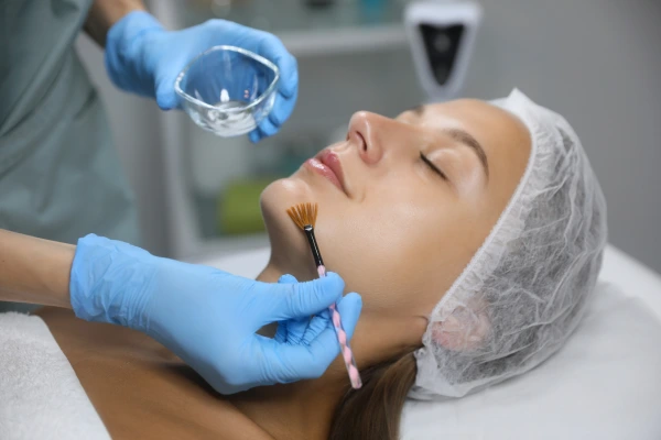 A young women taking chemical peel treatment on face
