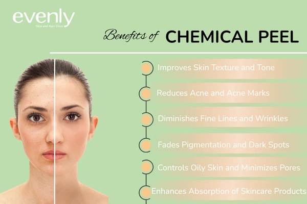 Benefits of chemical peel 