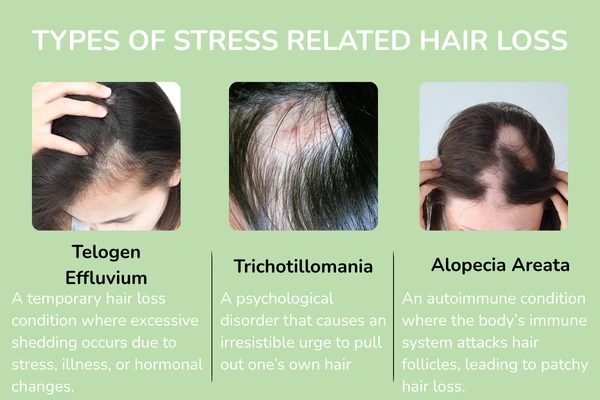 Types of stress related hair loss