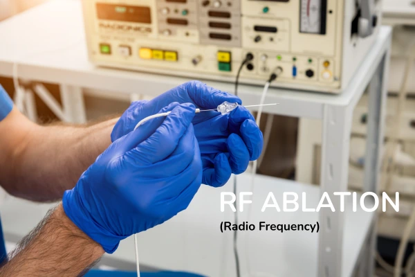 A dermat preparing the RF ablation set up for removing wart or mole
