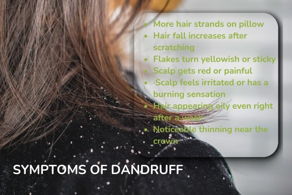 Symptoms of dandruff