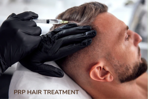PRP hair treatment for hair loss