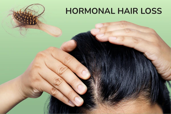 A women with hormonal hair loss