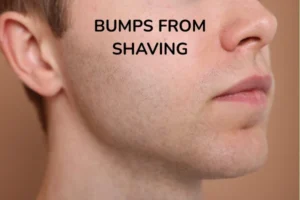 A men with bumps from shaving