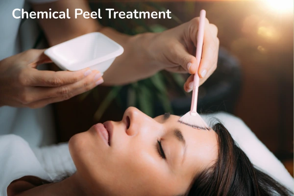 A women taking chemical peel treatment