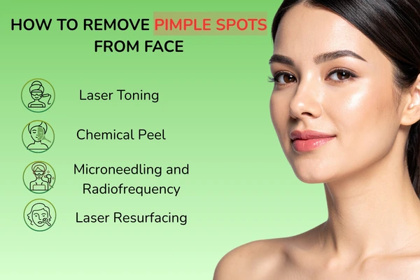 Advanced treatments to remove pimple spots on face