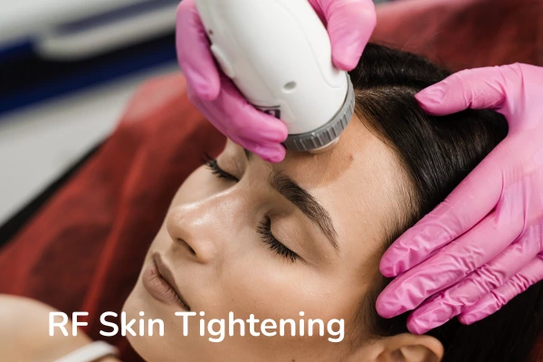 A women taking RF skin tightening