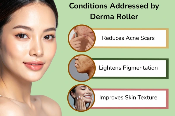 Conditions that treated by derma roller
