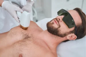 A young men taking laser hair removal treatment on his chest hair