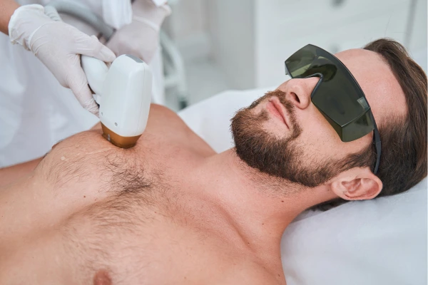 A young men taking laser hair removal treatment on his chest hair