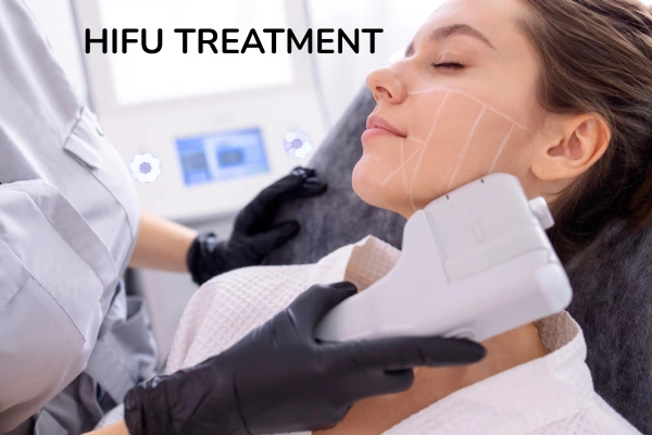 A women taking hifu treatment