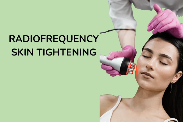RF skin tightening