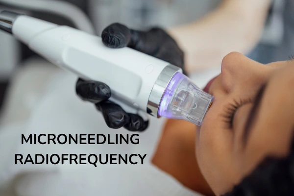 A women taking MNRF treatment for her jawline contouring