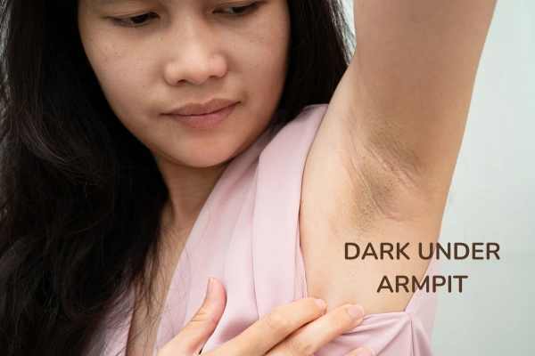 A women with dark underarmpit