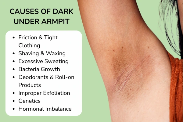 Causes of Dark underarmpit