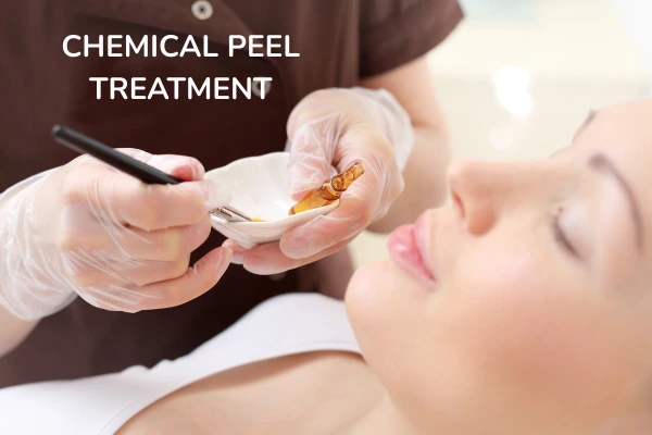 A women taking chemical peel treatment